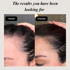 Wellberi's Hair Supplement™