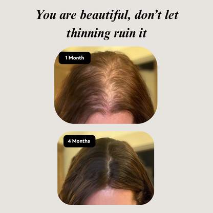 Wellberi's Hair Supplement™