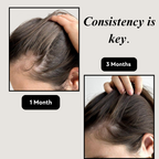 Wellberi's Hair Supplement™
