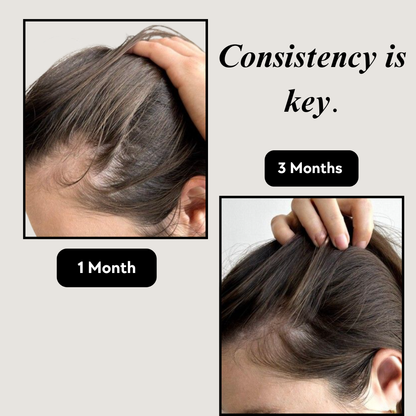 Wellberi's Hair Supplement™