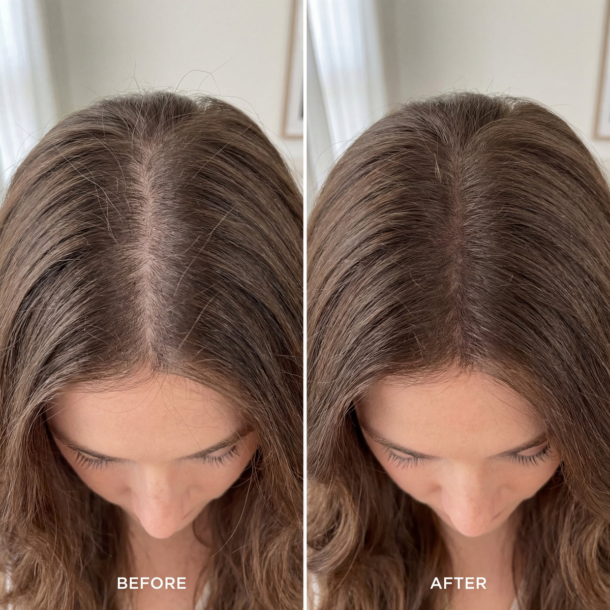 Wellberi's Hair Supplement™